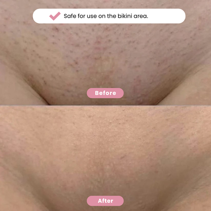 Eulyte™ Bikini Trimmer