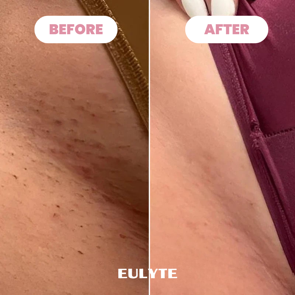 Eulyte™ Bikini Trimmer