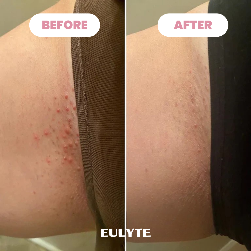 Eulyte™ Bikini Trimmer