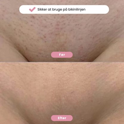 Eulyte™ Bikintrimmer