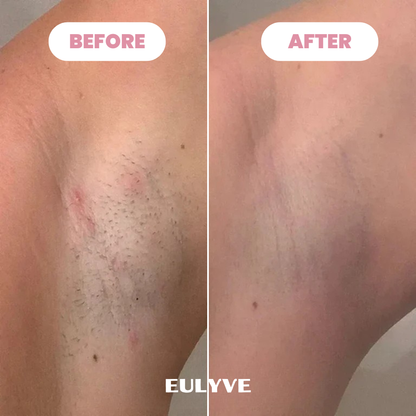 Eulyte™ Bikini Trimmer