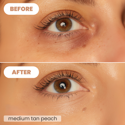 Eulyte™ ColorBalance Eye Corrector