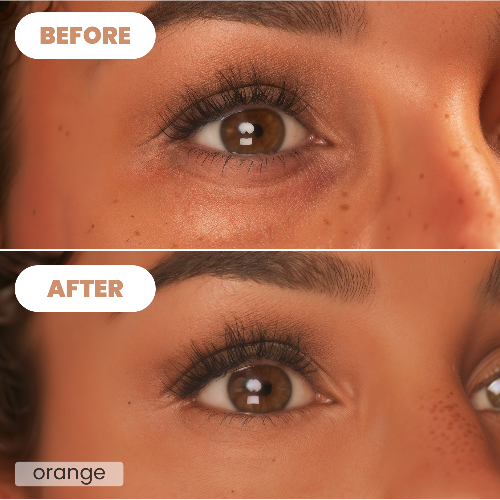 Eulyte™ ColorBalance Eye Corrector