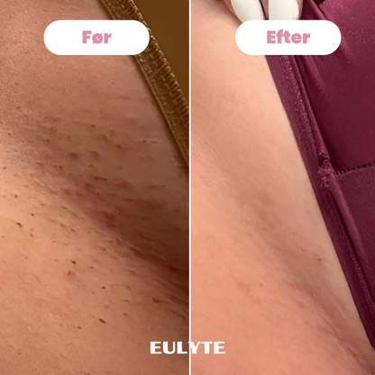 Eulyte™ Bikintrimmer