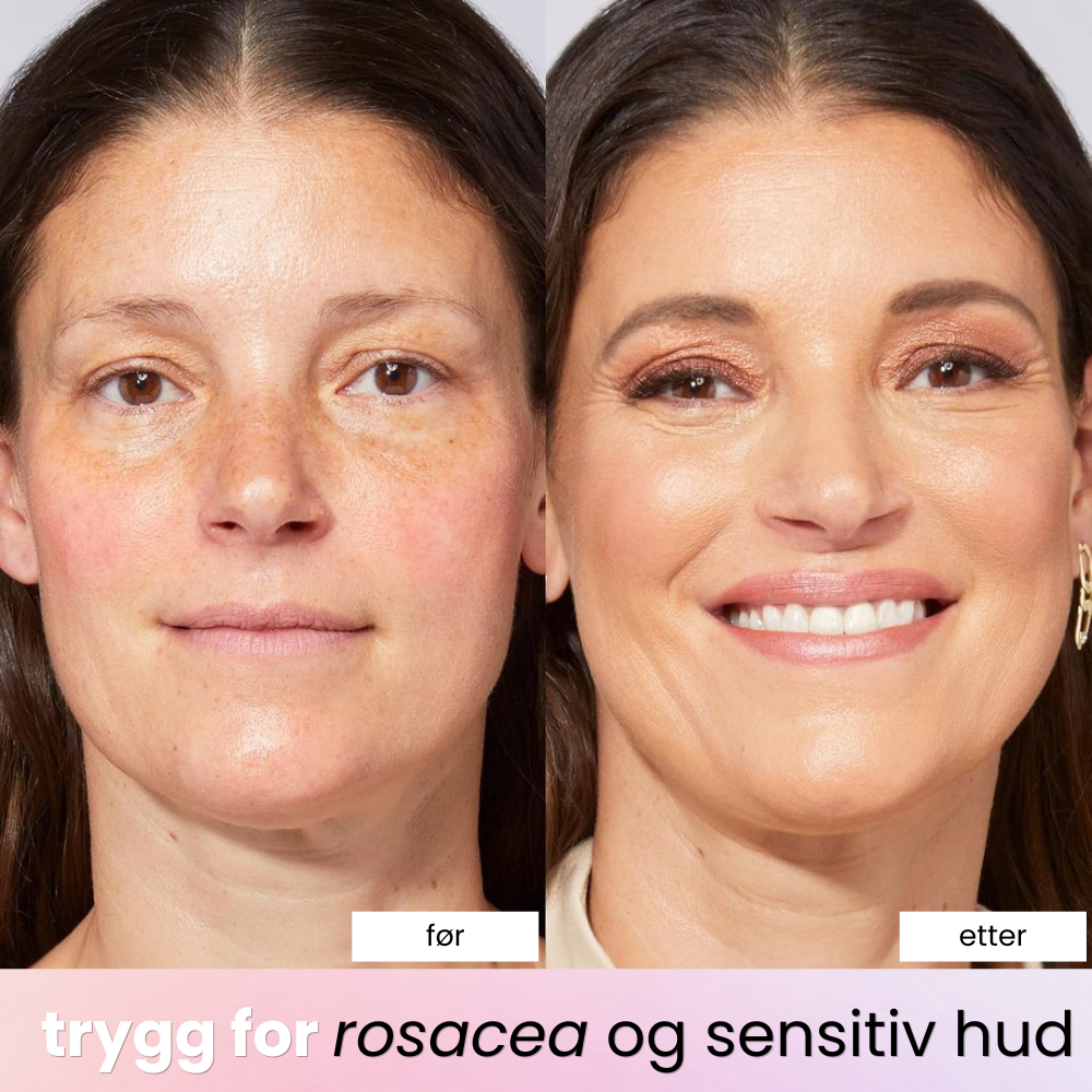 Eulyte™ BB Glow Cream