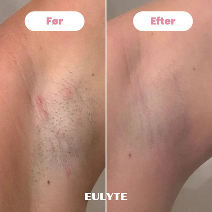 Eulyte™ Bikintrimmer