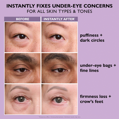 Eulyte™ InstantLift Eye Tightener