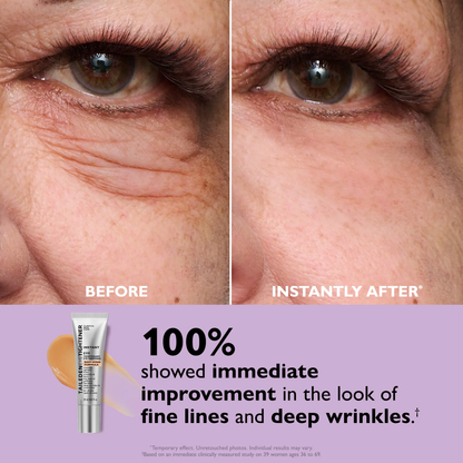 Eulyte™ InstantLift Eye Tightener